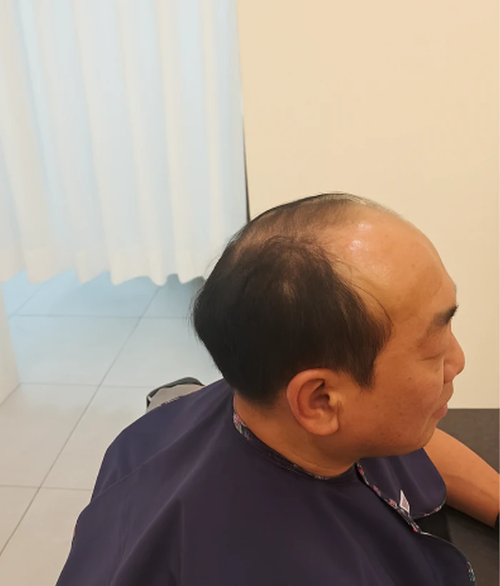 남성 전체가발 착용 전
